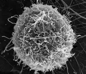 Ebola_Virus_Particles_(4)