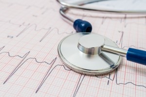 ECG