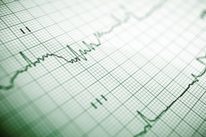 arresto cardiaco