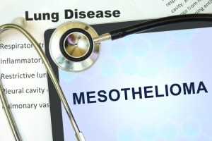 mesotelioma